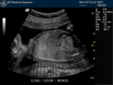 Logiq 7 CRT image